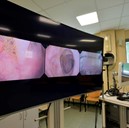 FUSE,  Full Spectrum Endoscopy